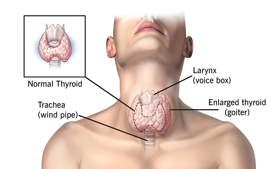 Hyperthyroidism Management